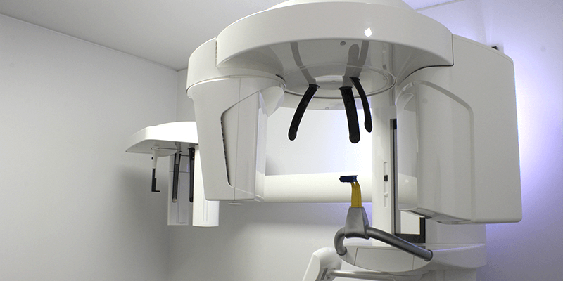 previadental-como-se-realiza-una-tomografia-dental