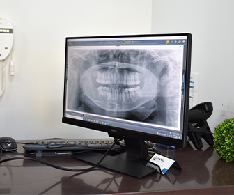previadental-odontologia-digital-conoce-cuales-son-las-mejores-tomografias-para-implantes-dentales
