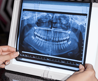 cuanto-cuesta-una-radiografia-panoramica-dental
