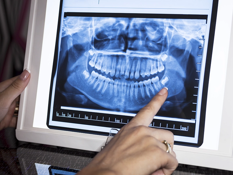 dental-hablemos-acerca-de-que-es-la-imagenologia-dental-previa-dental-works-tijuana